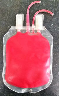 Cherry Red Discoloration of Blood Unit