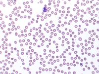 Romanowsky stain: oxidative changes