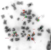 Reverse DAPI FISH image using BCR/ABL1 dual colour dual fusion probe+ Centromere enumeration probe for chromosome 12+ del(7q) triple colour deletion probe