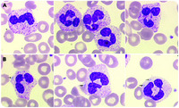 Never judge a book by its cover: these neutrophils are not reactive!