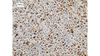 Myeloma-MPO immunostain