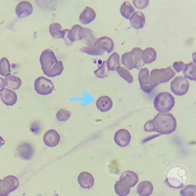 Plasmodium falciparum trophozoites 1