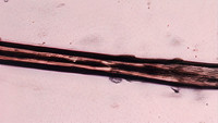 B. Light Microscopy of hair shaft showing evenly distributed melanin granules of equal diameter.