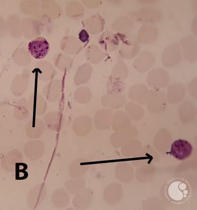 Plasmodium vivax  amoeboid and schizont forms in PBS 3