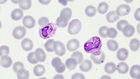 Plasmodium vivax ameboid trophozoites