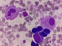 Prominent macrophages