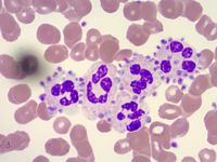 Photomicrographs from a Peripheral Blood Smear