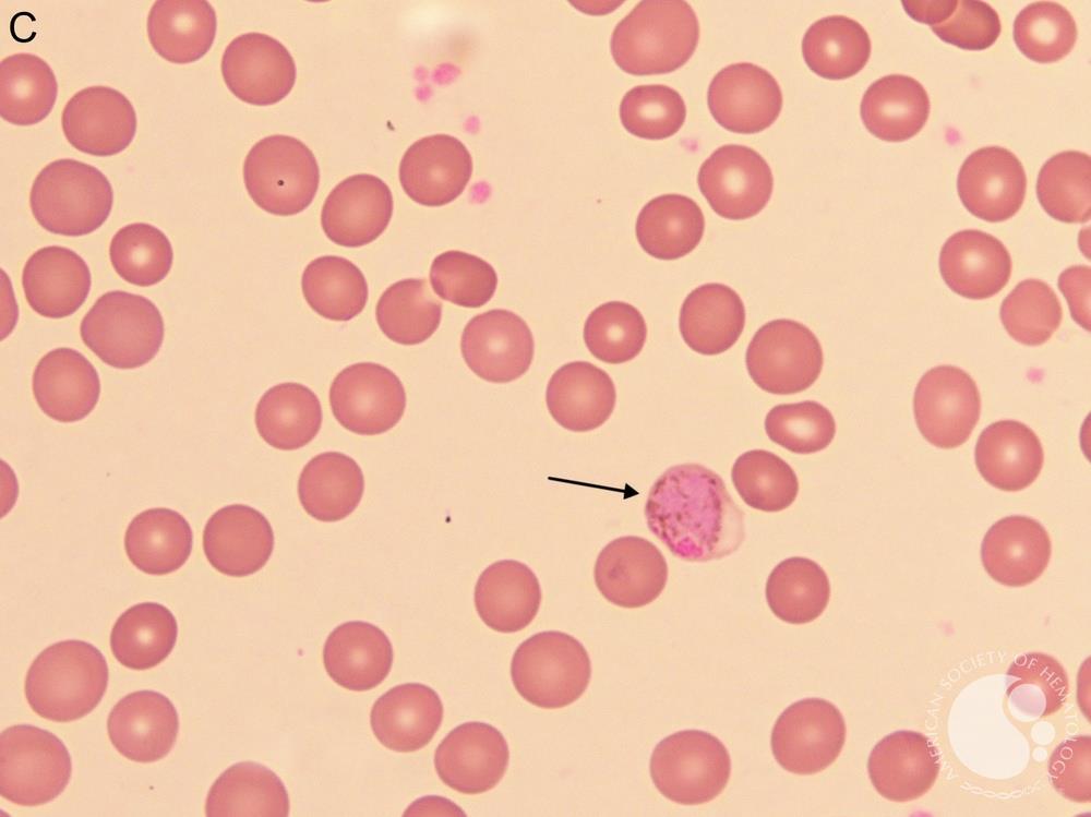 Plasmodium vivax gametocyte 2