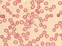 Plasmodium vivax trophozoite