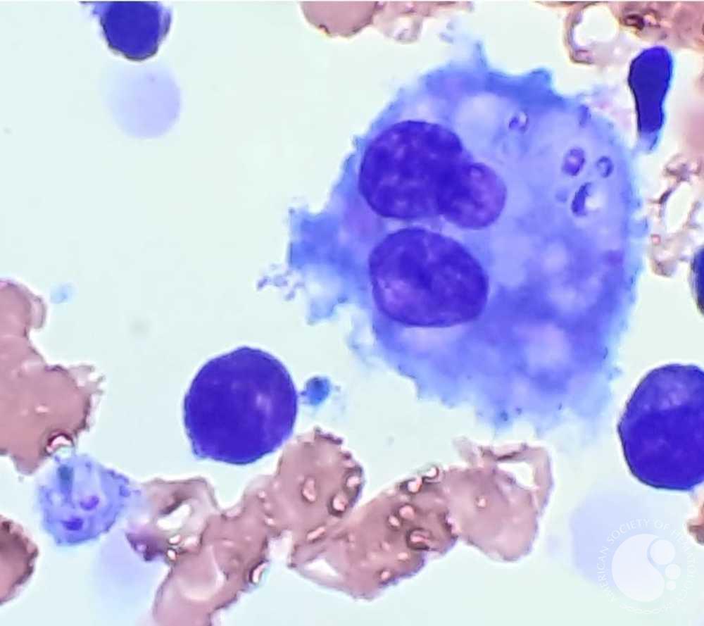 Macrófago fagocitando Histoplasma capsulatum
