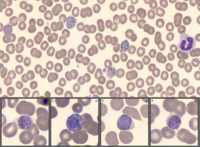 Plasmodium Vivax Infection - A case of long latency