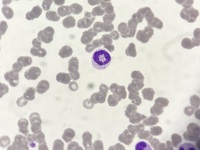 Ring neutrophil 2