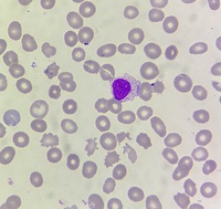 Large granular lymphocyte