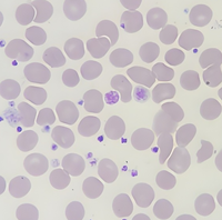 Large Platelets