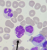 Basophil