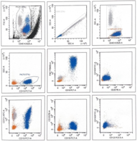 Flow cytometry in Splenic Marginal Zone Lymphoma 2