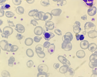 Nucleated red blood cell (NRBC) with basophilic stippling