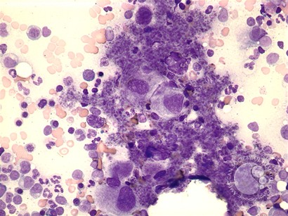 AML with inv(3) - 2.