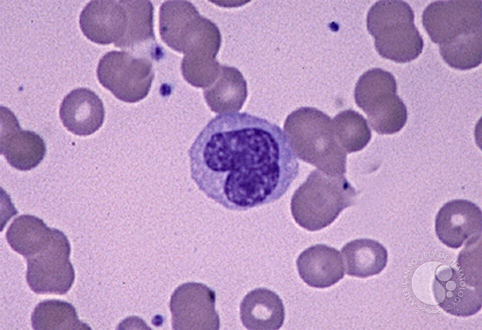 Monocyte 1.