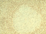 Normal Lymphoid Tissues: Part 2 - 10.