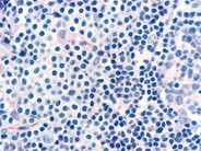 Normal Lymphoid Tissues: Part 2 - 13.