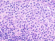 Normal Lymphoid Tissues Part 3 2 