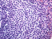 Normal Lymphoid Tissues: Part 4 - 4.