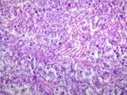 Normal Lymphoid Tissues: Part 4 - 6.