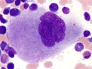 Megakaryocyte - 1.