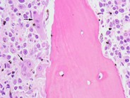 Bone Marrow Osteoclasts - 2.