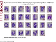 Neutrophil alphabet