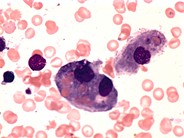 Erythrophagocytosis - 1.