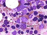 Eosinophilic Precursors - 2.