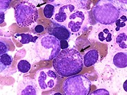 Eosinophilic Precursors - 3.