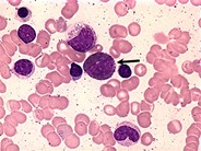 Eosinophilic Precursors - 4.