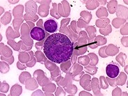 Eosinophilic Precursors - 5.