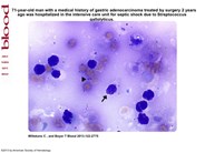 Bone marrow necrosis: a culture medium for bacteria