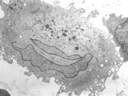 langerhans cells electron microscopy