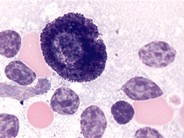 Mast Cell - 1.