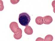 Nucleated Red Blood Cell - 1.