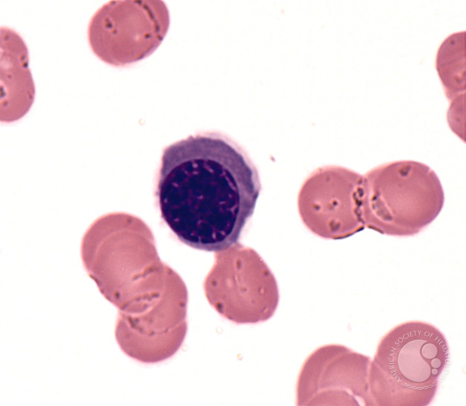 Nucleated Red Blood Cell - 1.