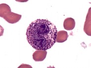 Eosinophil - 1.