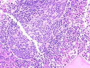 Marrow Germinal Center - 2.