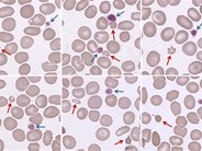 Small red blood cells mimicking platelets