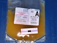 Platelet Component - 1.