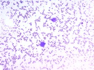 renal osteodystrophy histology