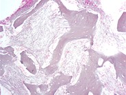 renal osteodystrophy histology