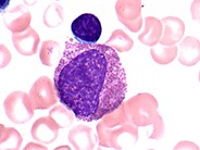 Eosinophilic Myelocyte - 1.