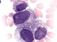 Promyelocytes - 1.