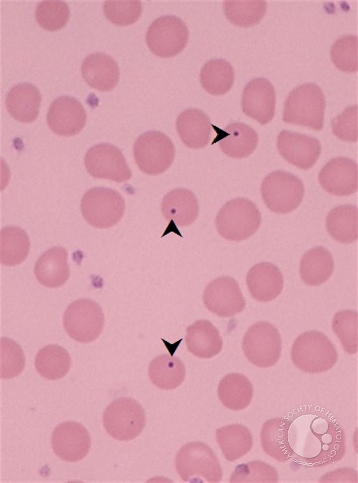 Кольца кебота фото Кольца кебота фото